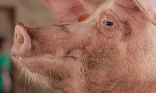 Anemia y desnutrición